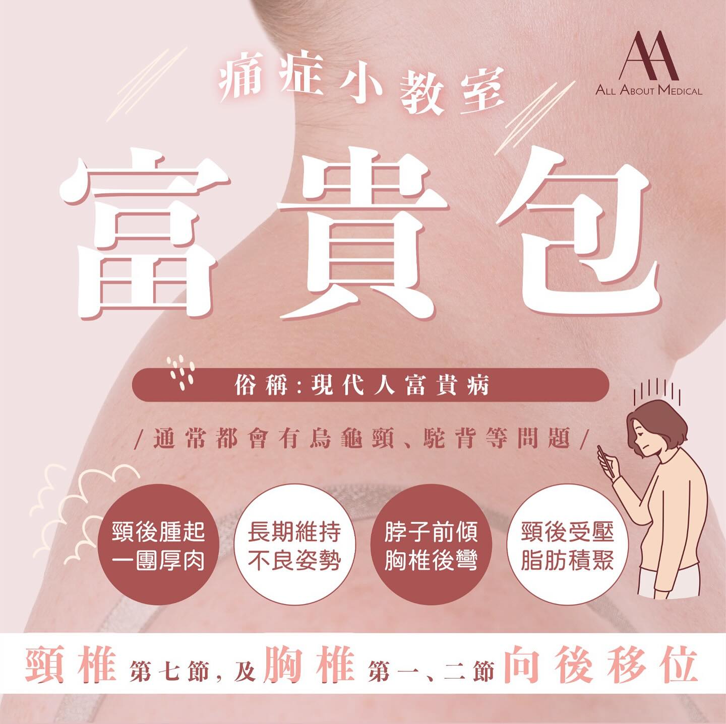 【痛症小教室 | 富貴包 👩🏻‍🏫】